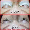 Extension ciglia