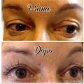 Extension ciglia