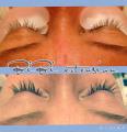 Extension ciglia
